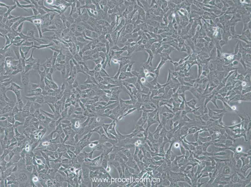 HTR-8-Svneo (人絨毛膜滋養(yǎng)層細胞) (STR鑒定正確)