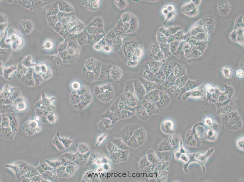 HCC1428 (人乳腺腺癌細(xì)胞) (STR鑒定正確)