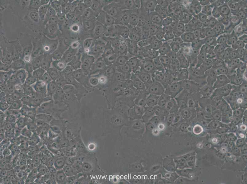 SACC-83 (人涎腺腺樣囊性癌細(xì)胞) (STR鑒定正確)