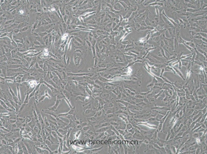 OCUT-2C (人甲狀腺癌細胞（未分化）) (STR鑒定正確)