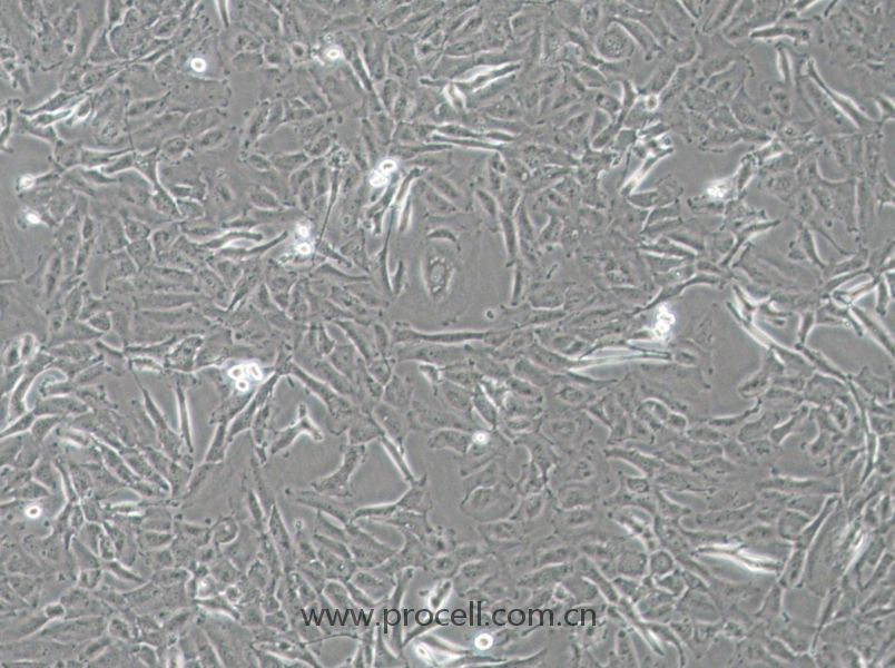 OCUT-2C (人甲狀腺癌細胞（未分化）) (STR鑒定正確)