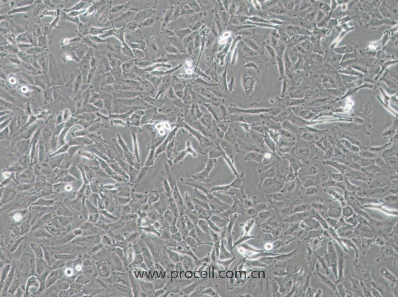 OCUT-2C (人甲狀腺癌細胞（未分化）) (STR鑒定正確)