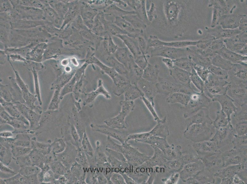 OCUT-2C (人甲狀腺癌細胞（未分化）) (STR鑒定正確)