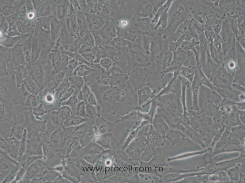 OCUT-2C (人甲狀腺癌細胞（未分化）) (STR鑒定正確)