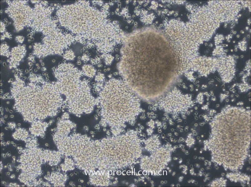 NCI-BL2009 (人淋巴母細(xì)胞（EBV 轉(zhuǎn)化）) (STR鑒定正確)