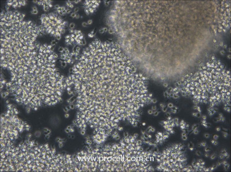 NCI-BL2009 (人淋巴母細(xì)胞（EBV 轉(zhuǎn)化）) (STR鑒定正確)