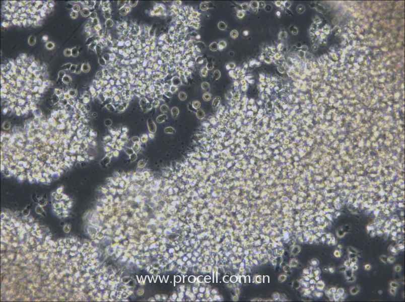 NCI-BL2009 (人淋巴母細(xì)胞（EBV 轉(zhuǎn)化）) (STR鑒定正確)