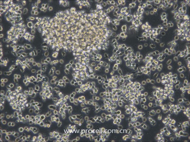 HCC38 BL (人淋巴母細(xì)胞（EBV 轉(zhuǎn)化）) (STR鑒定正確)