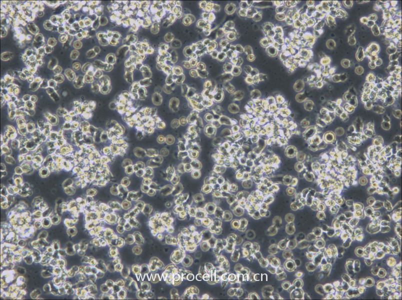 HCC38 BL (人淋巴母細(xì)胞（EBV 轉(zhuǎn)化）) (STR鑒定正確)