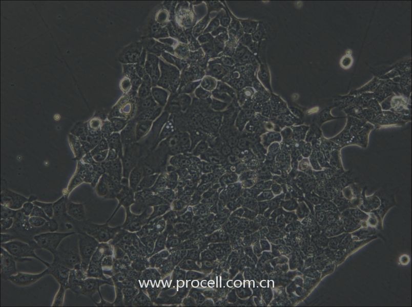 OE33 (人食管腺癌細(xì)胞) (STR鑒定正確)