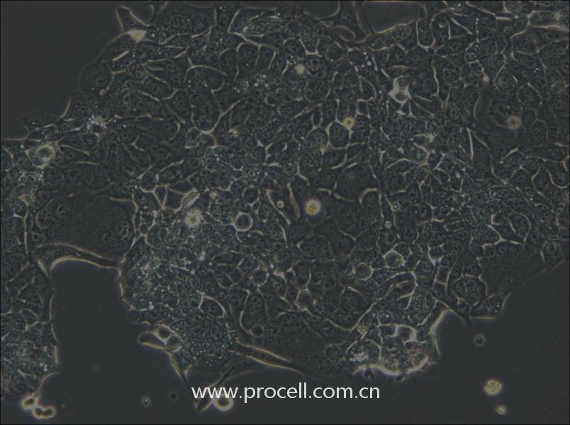 OE33 (人食管腺癌細(xì)胞) (STR鑒定正確)