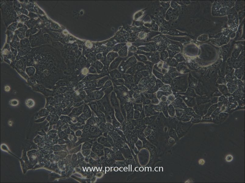 OE33 (人食管腺癌細(xì)胞) (STR鑒定正確)