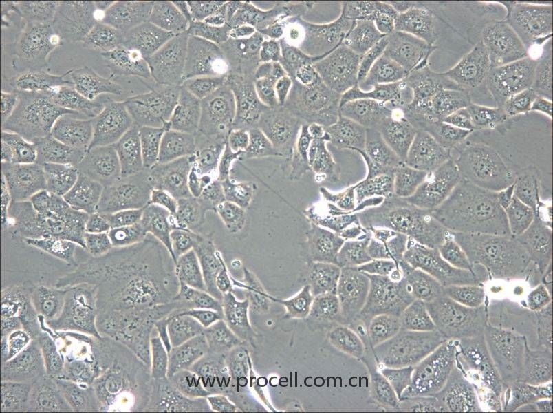 NCI-H1693 (人肺腺癌細(xì)胞) (STR鑒定正確)