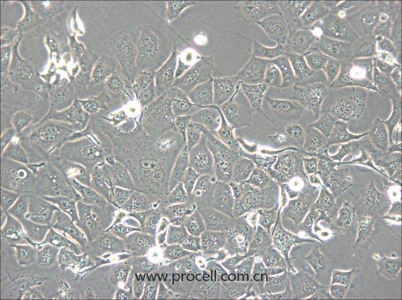 NCI-H1693 (人肺腺癌細(xì)胞) (STR鑒定正確)