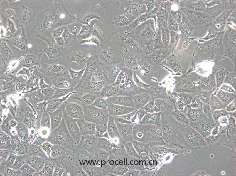 NCI-H1693 (人肺腺癌細(xì)胞) (STR鑒定正確)