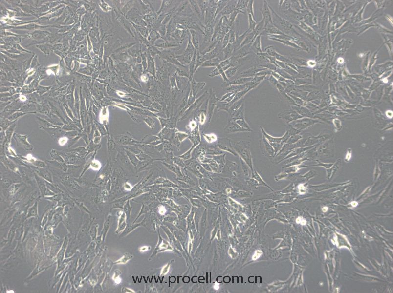 SW1783  (人腦星形膠質(zhì)細胞瘤細胞) (STR鑒定正確)