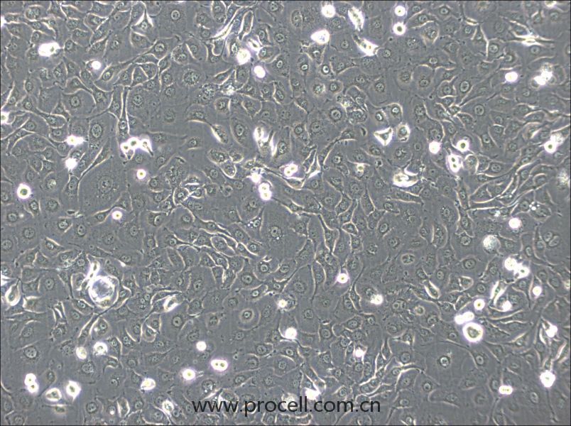 HSC-2 (人口腔鱗狀腫瘤細(xì)胞) (STR鑒定正確)