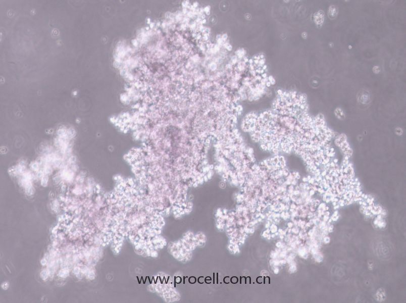 NCI-H660 (人神經(jīng)內(nèi)分泌前列腺癌細(xì)胞) (STR鑒定正確)