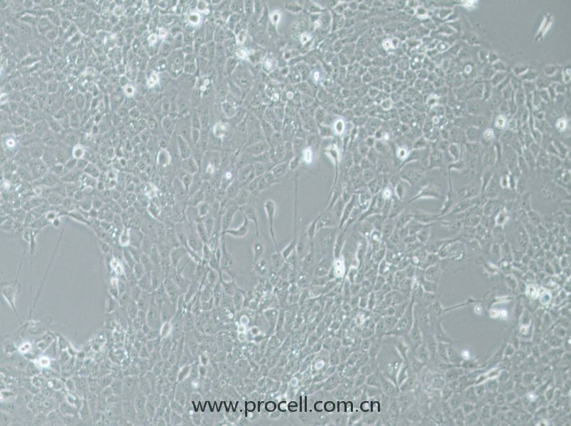 UM-SCC-1 (人口底鱗癌細(xì)胞) (STR鑒定正確)