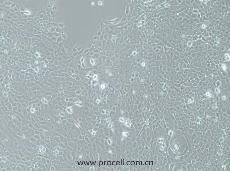 UM-SCC-1 (人口底鱗癌細(xì)胞) (STR鑒定正確)