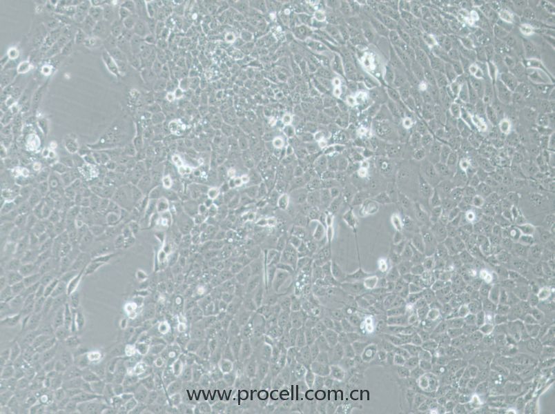 UM-SCC-1 (人口底鱗癌細(xì)胞) (STR鑒定正確)