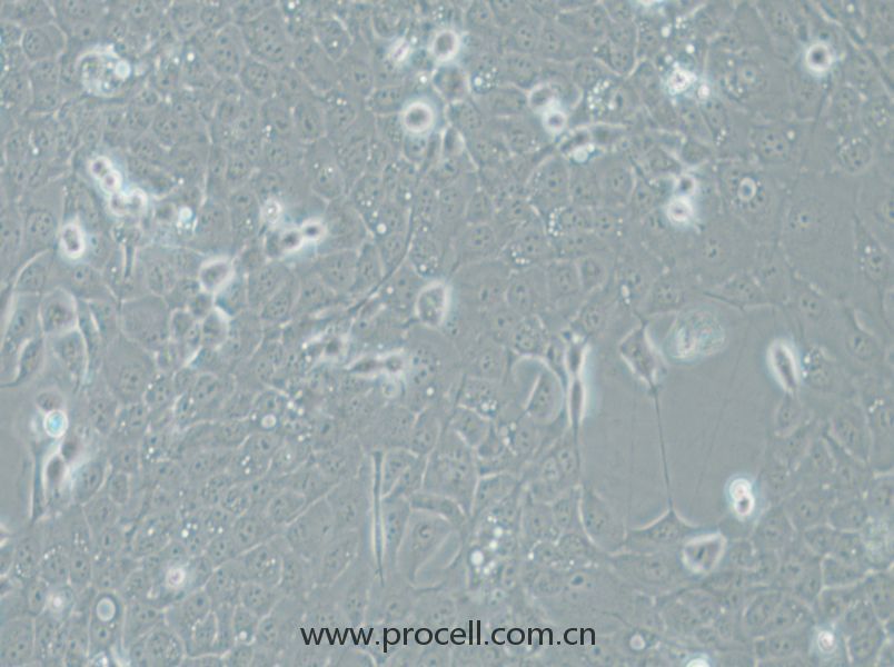 UM-SCC-1 (人口底鱗癌細(xì)胞) (STR鑒定正確)