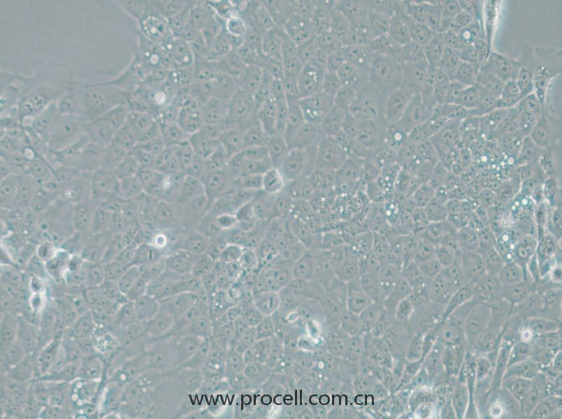 UM-SCC-1 (人口底鱗癌細(xì)胞) (STR鑒定正確)