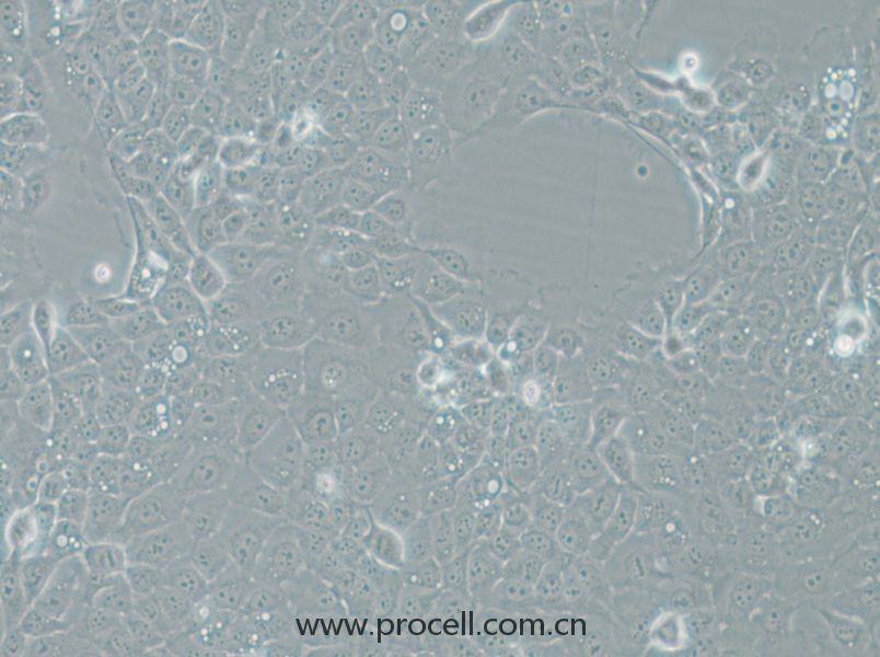 UM-SCC-1 (人口底鱗癌細(xì)胞) (STR鑒定正確)