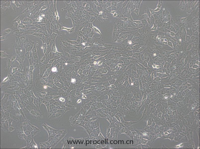 NCI-H1792(人肺腺癌細(xì)胞) (STR鑒定正確)