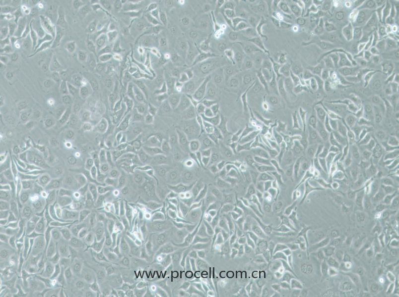 HCC1143 (人乳腺癌細胞) (STR鑒定正確)