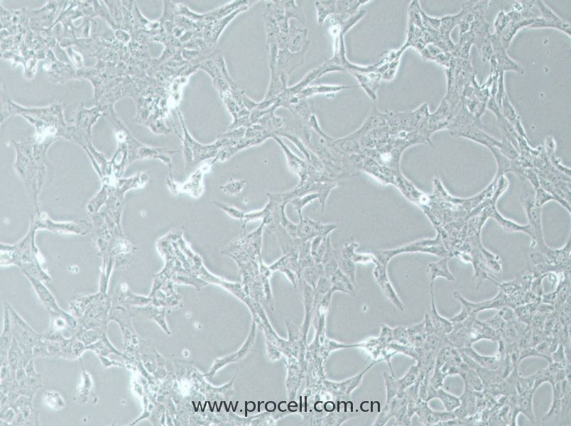 HLE-B3 (人晶狀體上皮細(xì)胞) (STR鑒定正確)