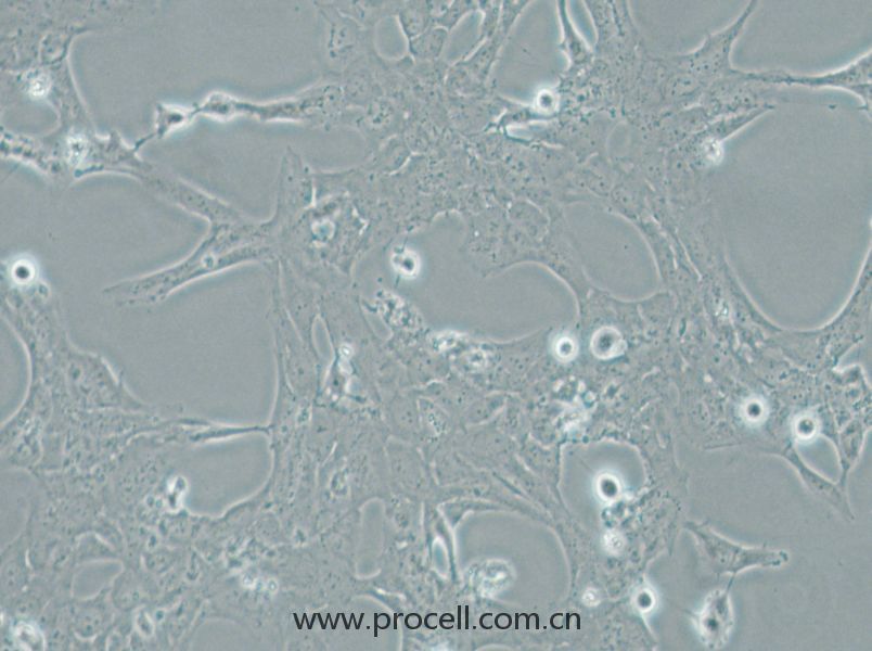 HLE-B3 (人晶狀體上皮細(xì)胞) (STR鑒定正確)