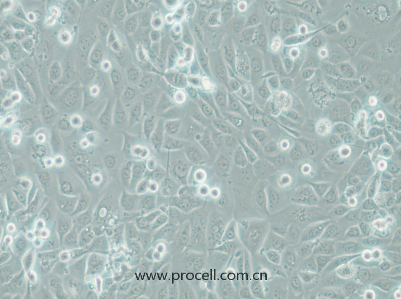 COLO-680N (人食管鱗狀細胞癌) (STR鑒定正確)