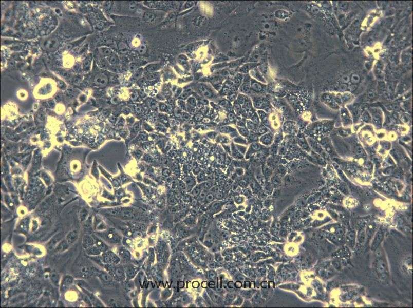 CL-11(人結(jié)腸癌細胞) (STR鑒定正確)