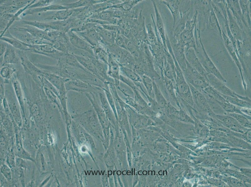 SW1088 (人腦星形膠質(zhì)瘤細(xì)胞) (STR鑒定正確)